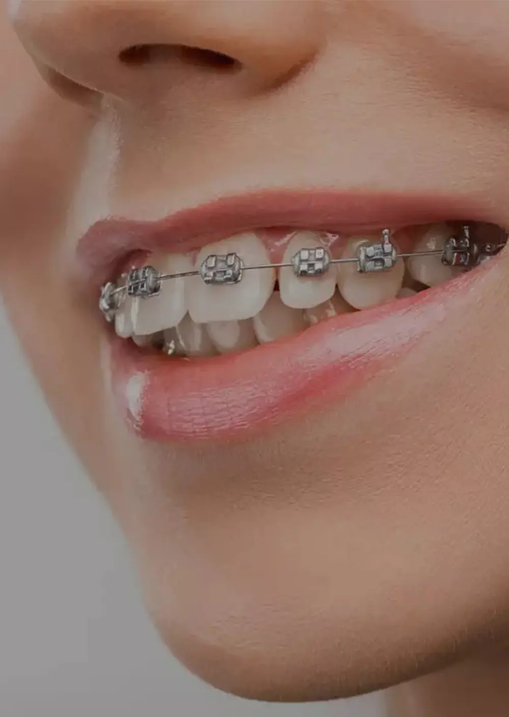 Orthodontic